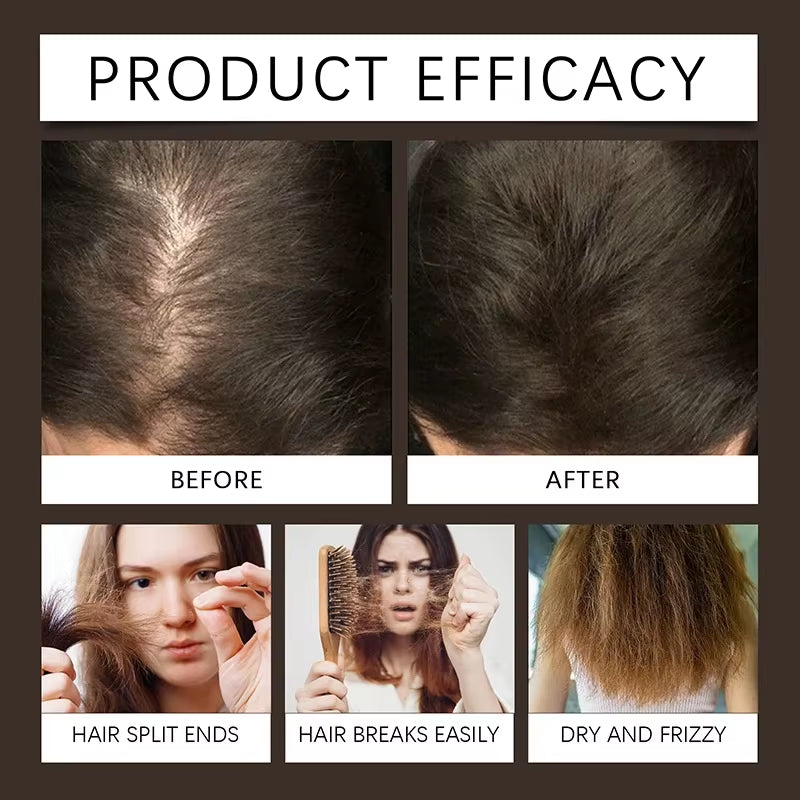 Biotin Fast Hair Growth Spray anti Hair Loss Serum Prevent Baldness Treatment Scalp Beard Beauty Essence Hair Care Products 30Ml