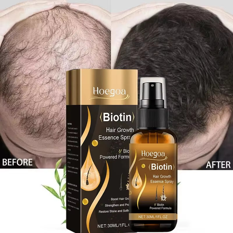 Biotin Fast Hair Growth Spray anti Hair Loss Serum Prevent Baldness Treatment Scalp Beard Beauty Essence Hair Care Products 30Ml