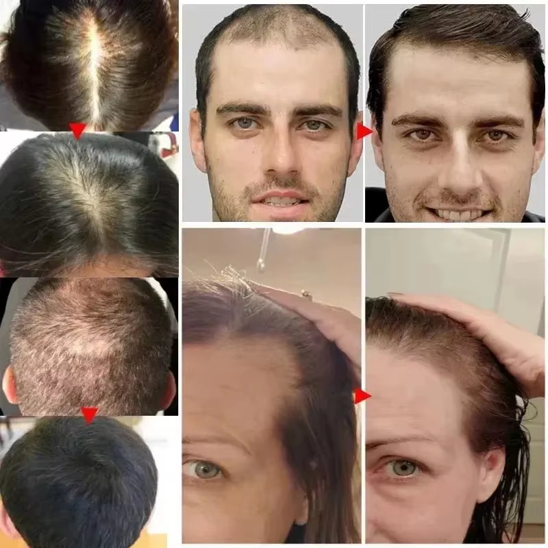 Biotin Fast Hair Growth Spray anti Hair Loss Serum Prevent Baldness Treatment Scalp Beard Beauty Essence Hair Care Products 30Ml